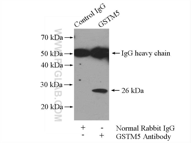 IP experiment of mouse skeletal muscle using 14502-1-AP