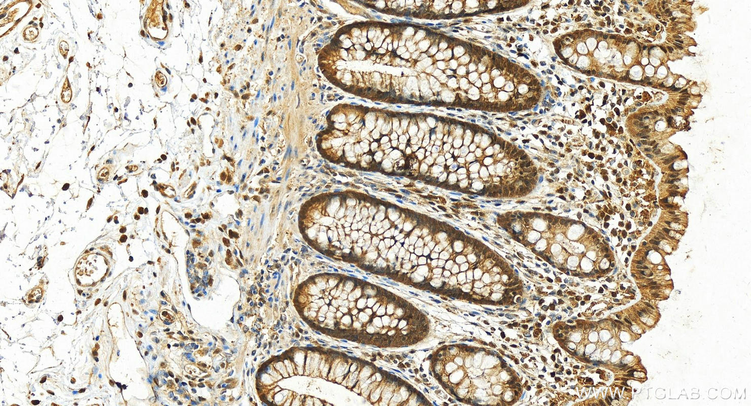 IHC staining of human  colon using 15902-1-AP