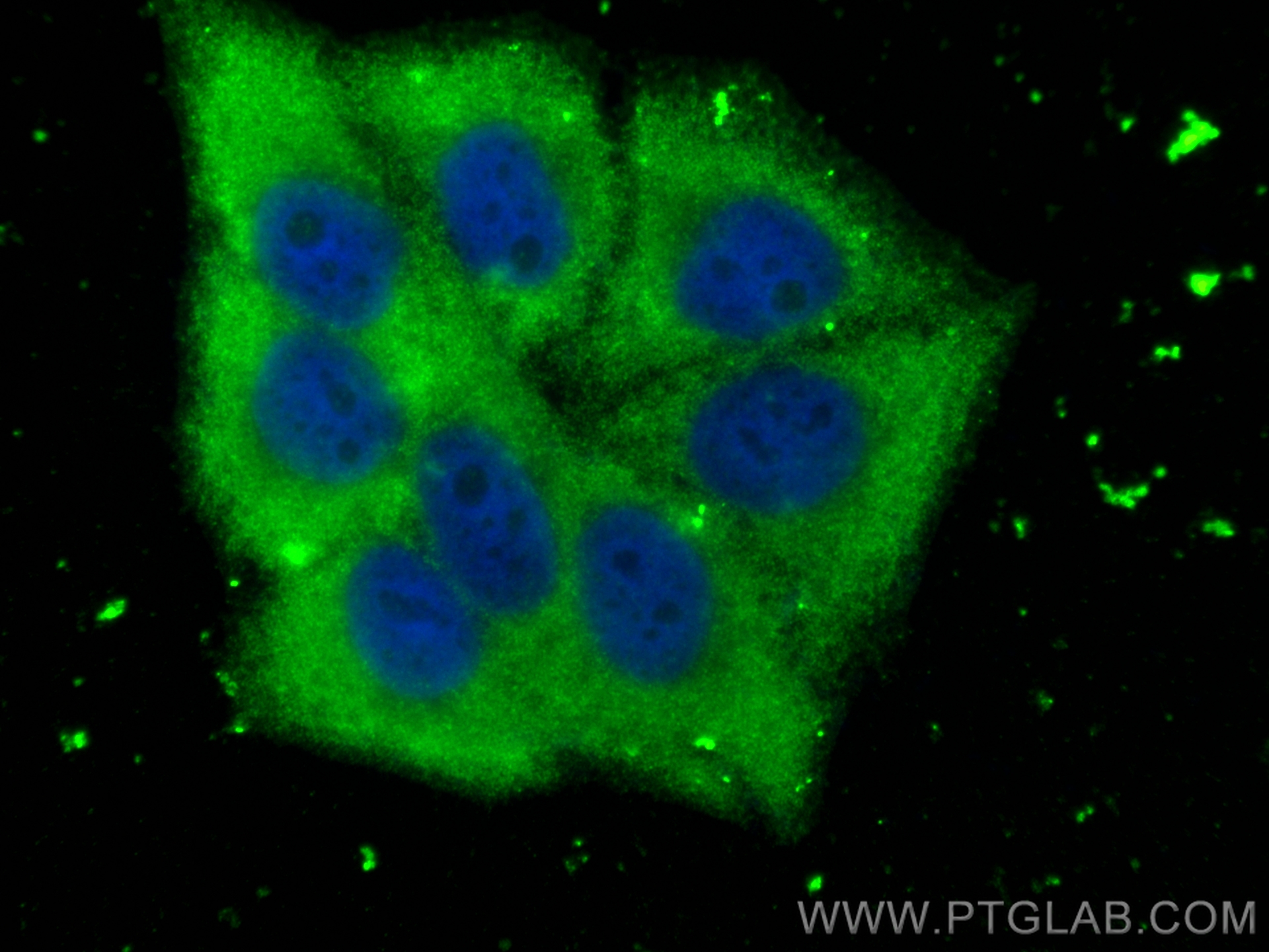 IF Staining of HepG2 using 15902-1-AP