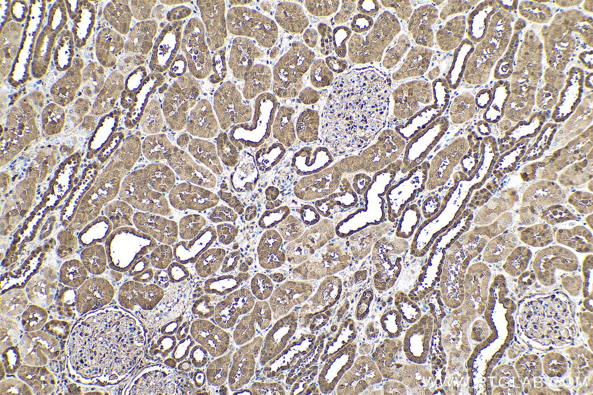 IHC staining of human kidney using 66715-1-Ig