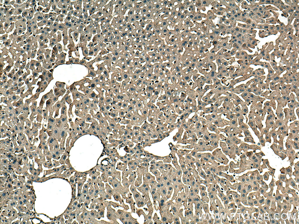 IHC staining of mouse liver using 67645-1-Ig