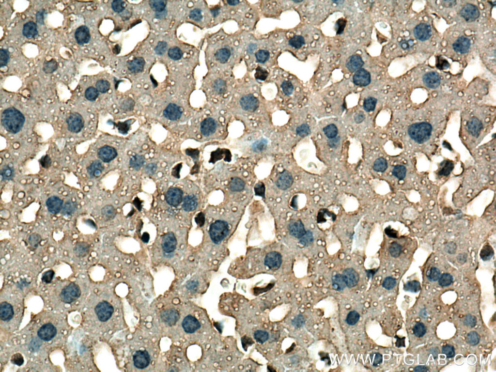 IHC staining of mouse liver using 67645-1-Ig
