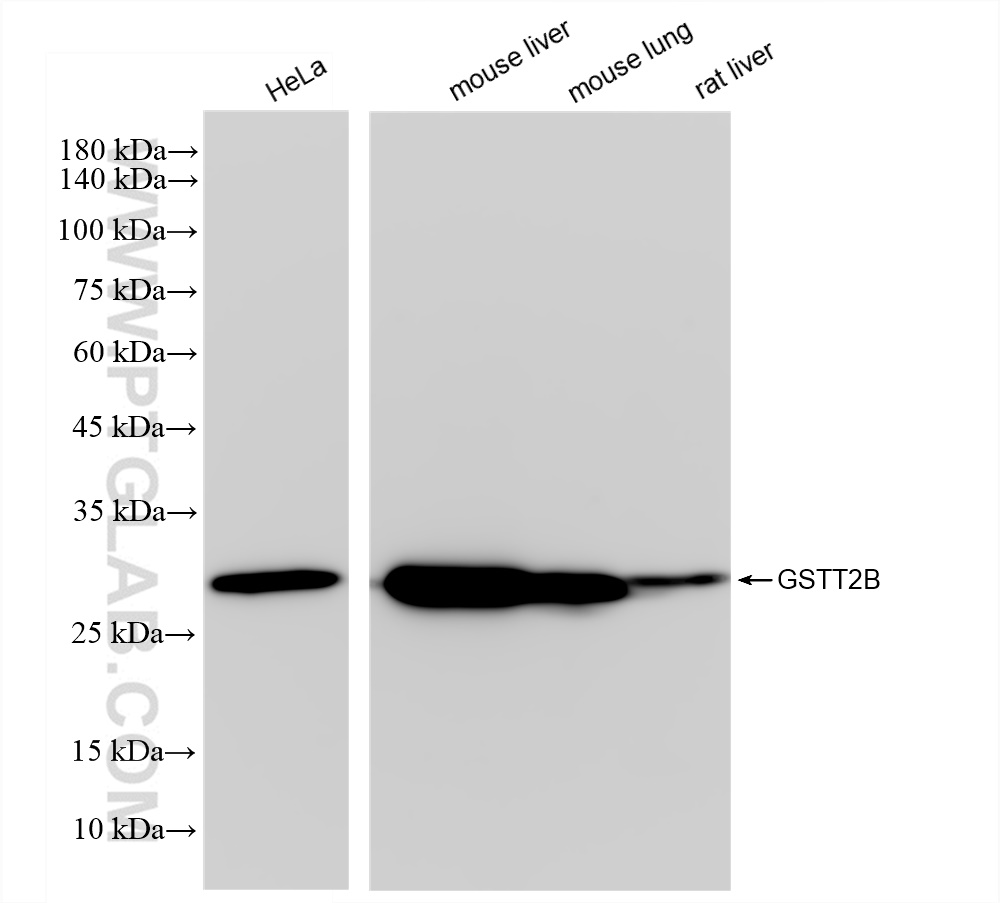 WB analysis using 83469-4-RR (same clone as 83469-4-PBS)