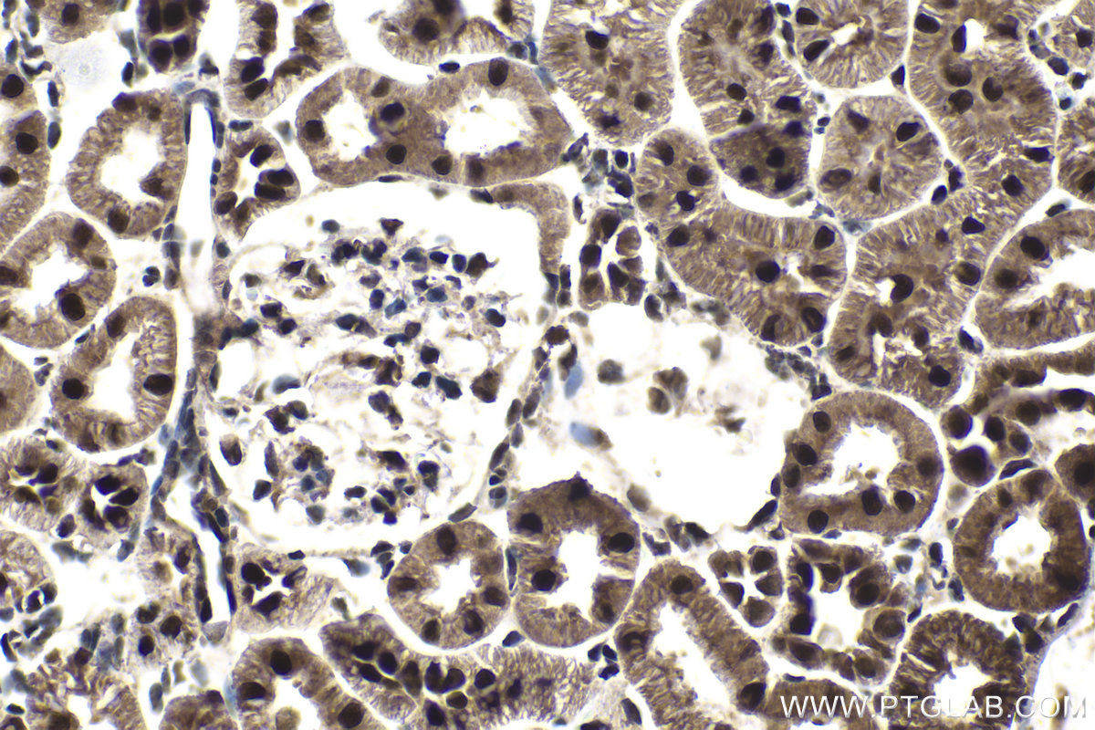 IHC staining of rat kidney using 24405-1-AP