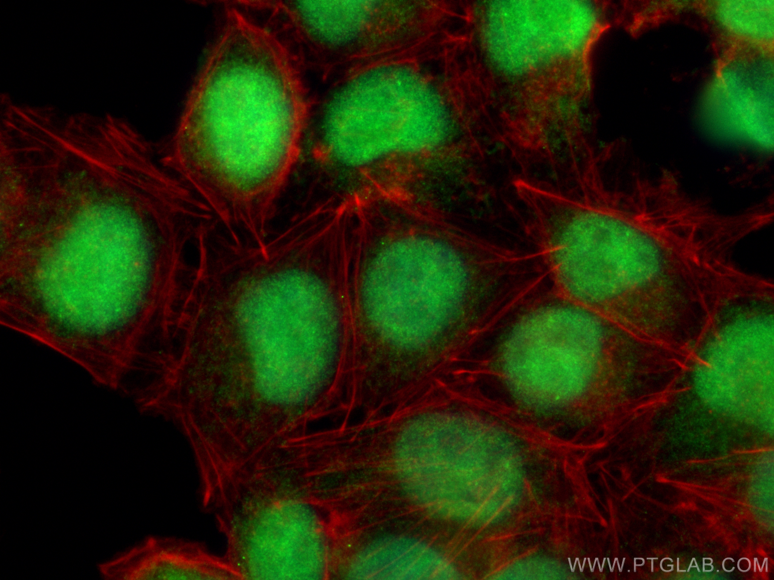 IF Staining of A375 using 11596-1-AP