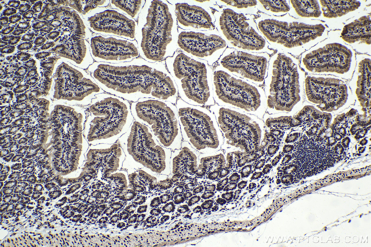 IHC staining of mouse small intestine using 10499-1-AP