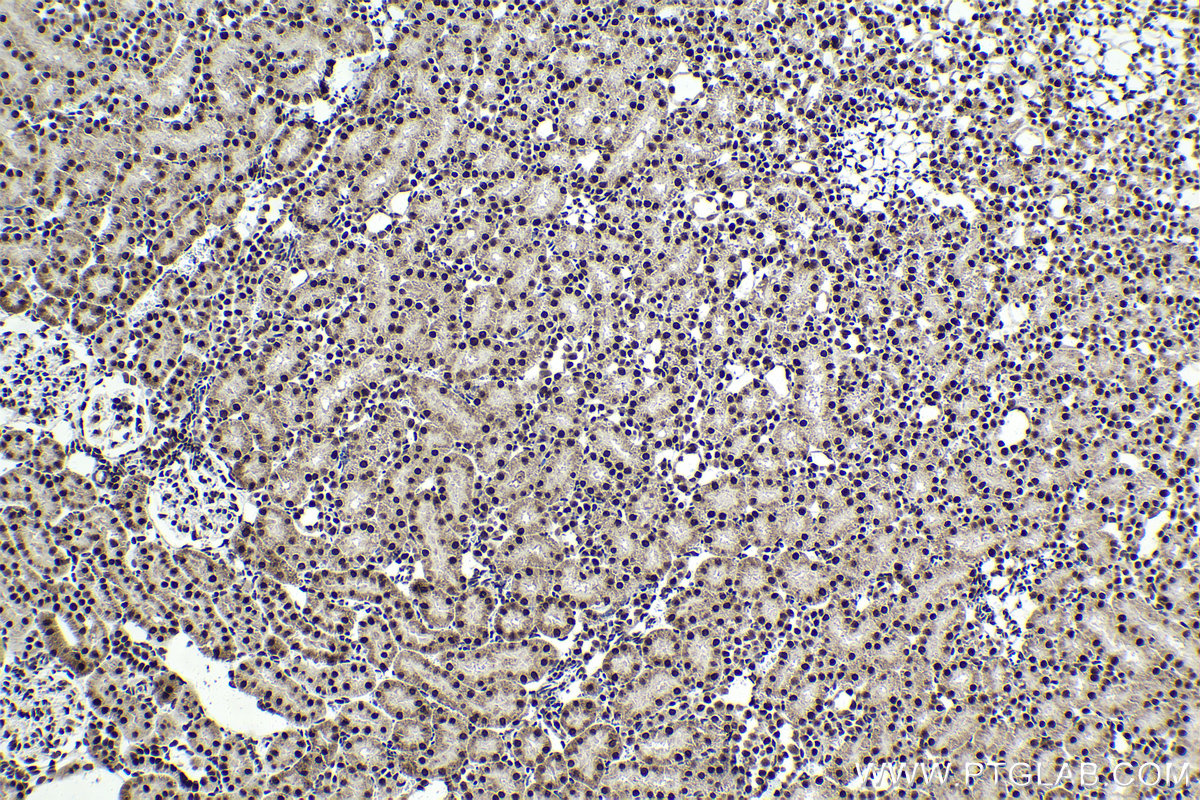 IHC staining of rat kidney using 10499-1-AP