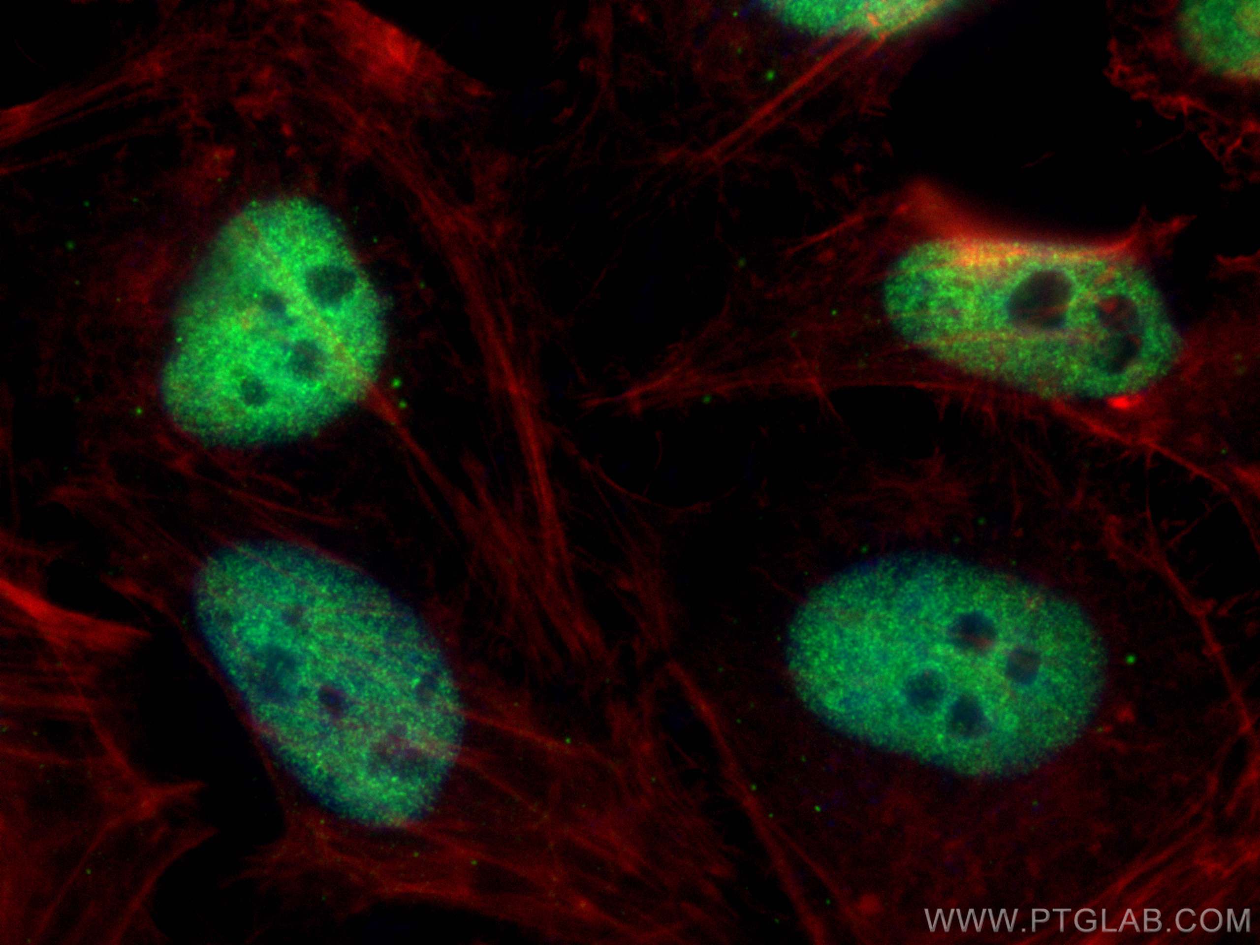 IF Staining of HeLa using 27494-1-AP