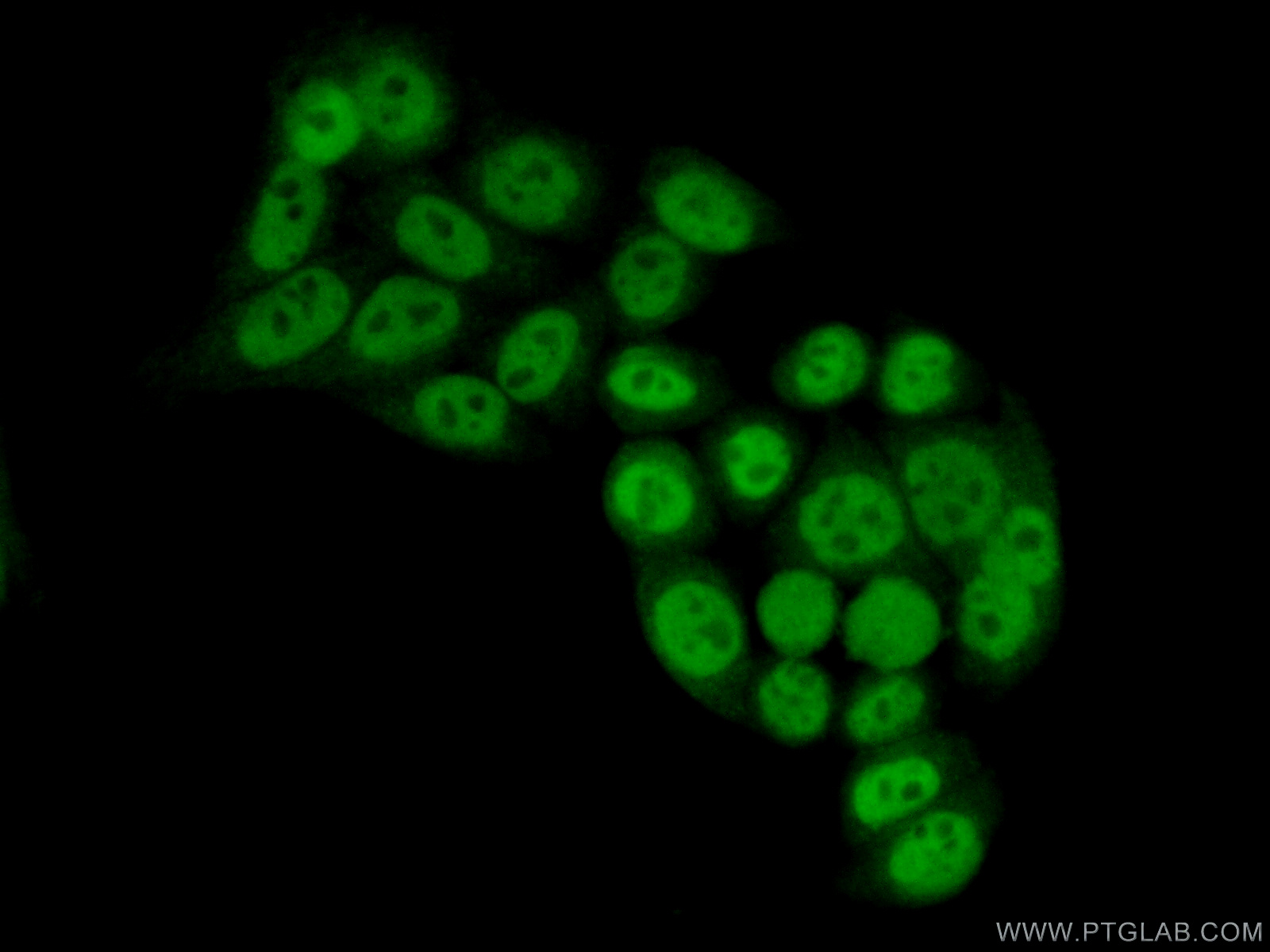 IF Staining of HeLa using 17653-1-AP