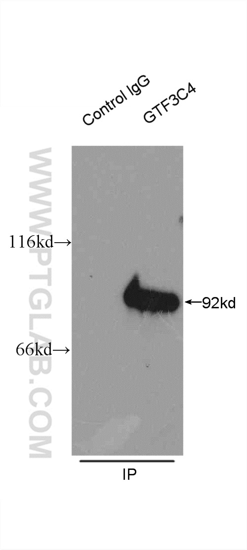 IP experiment of HeLa using 17653-1-AP