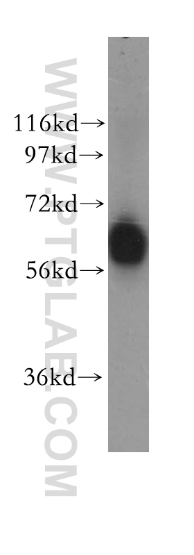 WB analysis of human lung using 11447-2-AP