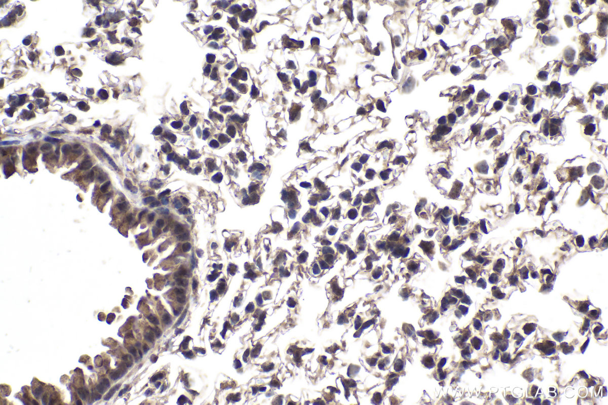 IHC staining of mouse lung using 26382-1-AP