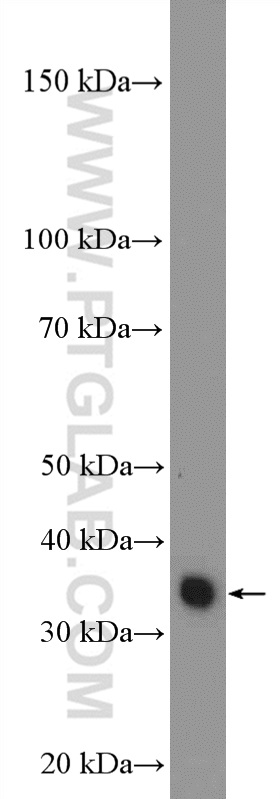 WB analysis of HeLa using 26382-1-AP