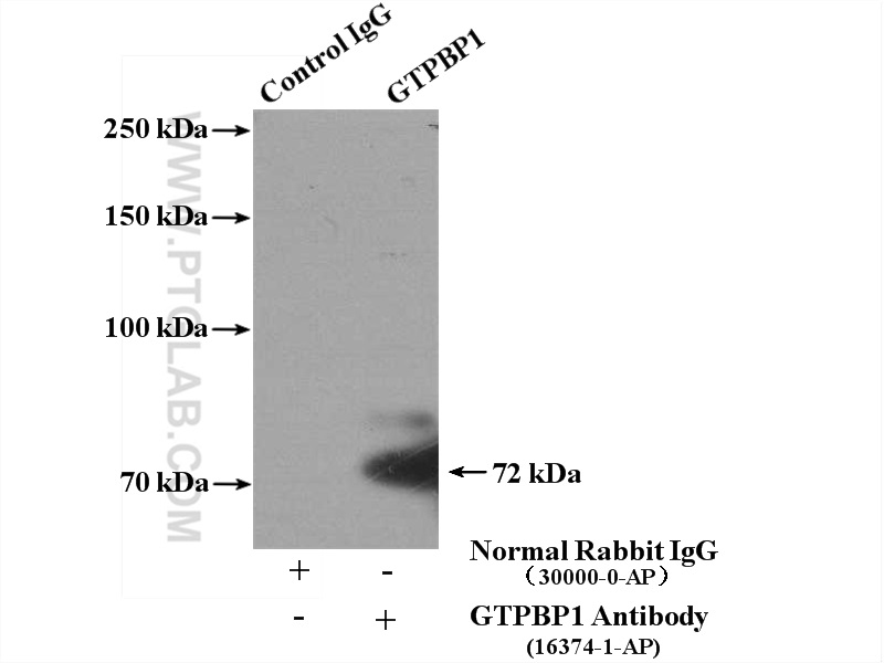 IP experiment of mouse skeletal muscle using 16374-1-AP