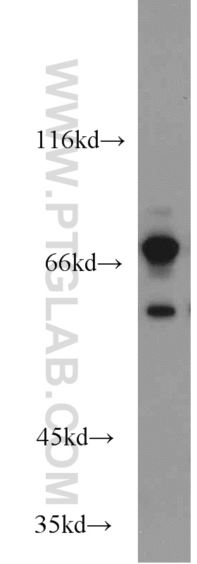 WB analysis of mouse skeletal muscle using 16374-1-AP