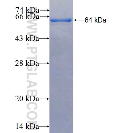 GTPBP2 fusion protein Ag2113 SDS-PAGE