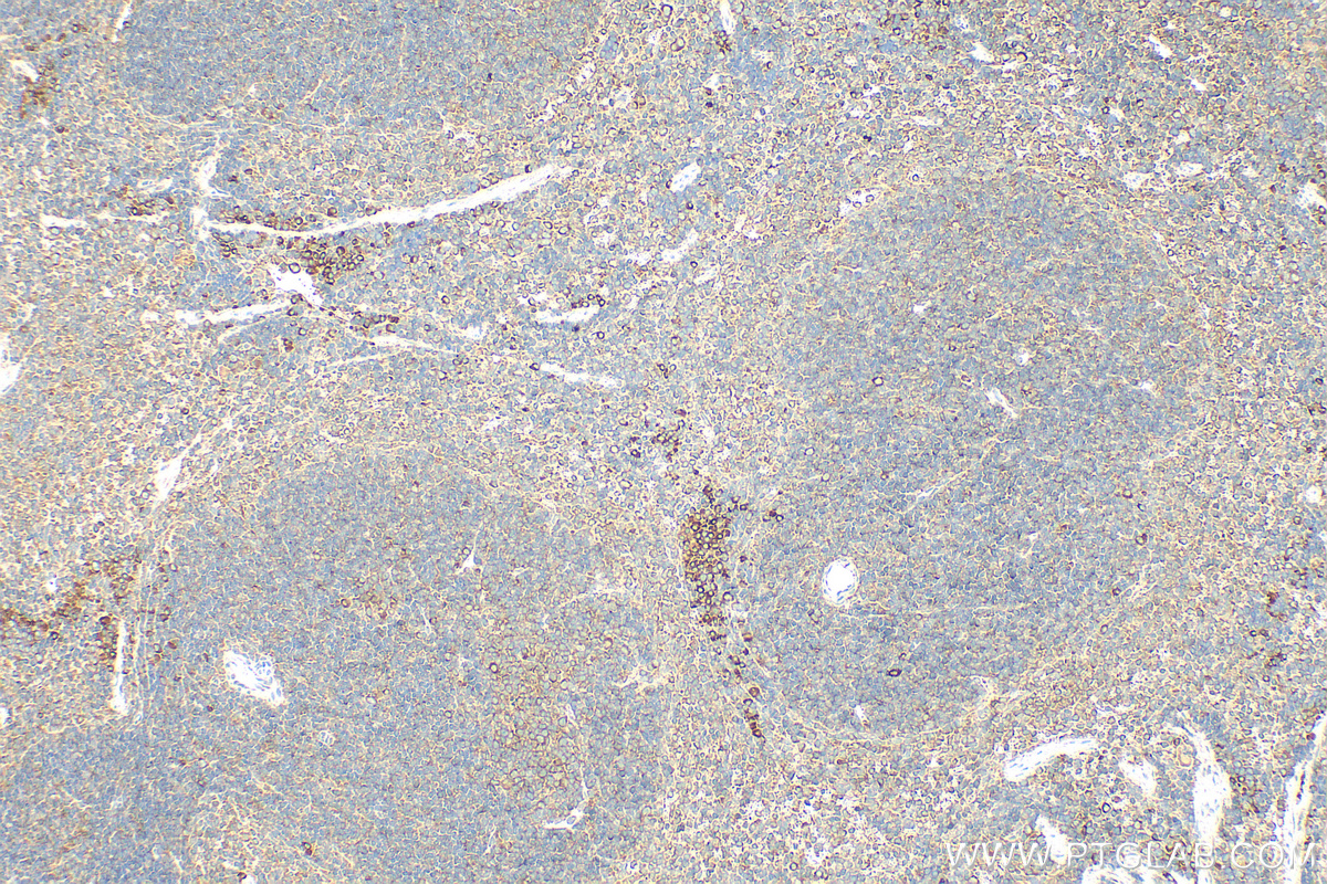 IHC staining of mouse spleen using 21319-1-AP