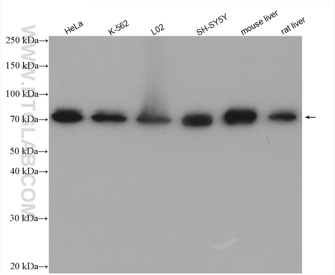 WB analysis using 21319-1-AP