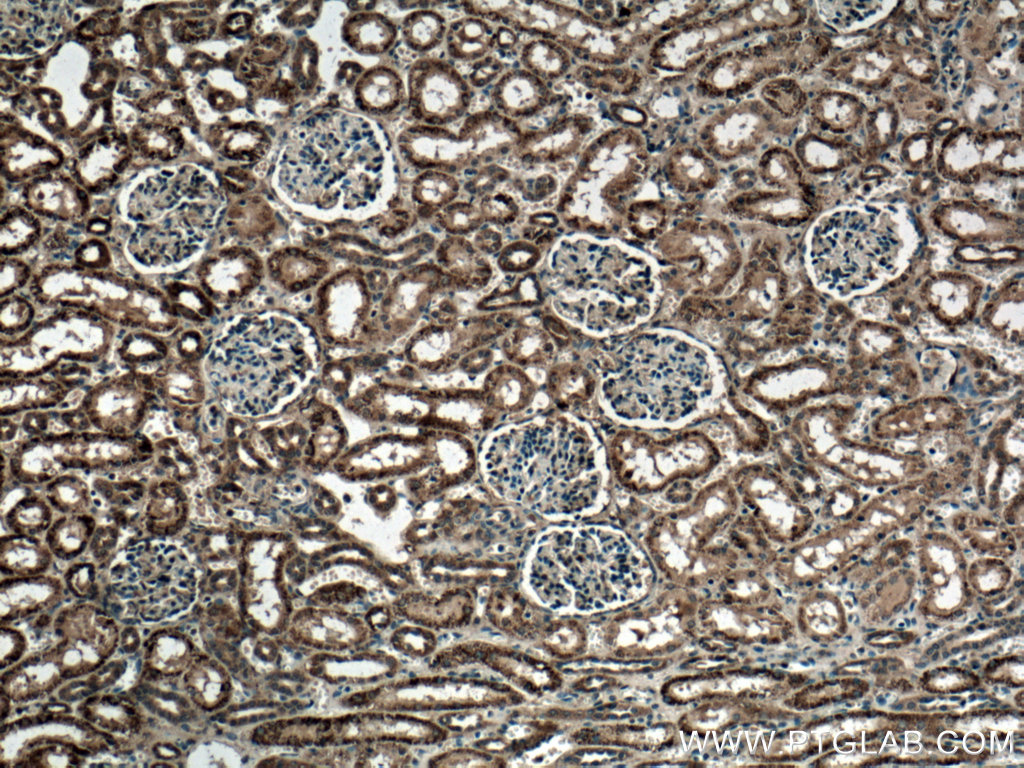 IHC staining of human kidney using 10755-1-AP