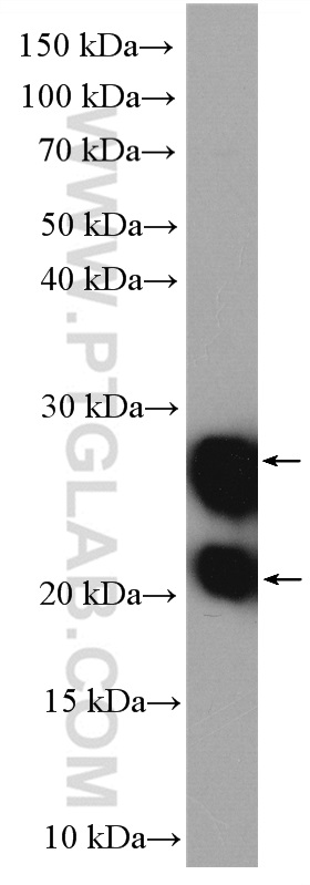 WB analysis of HeLa using 10755-1-AP