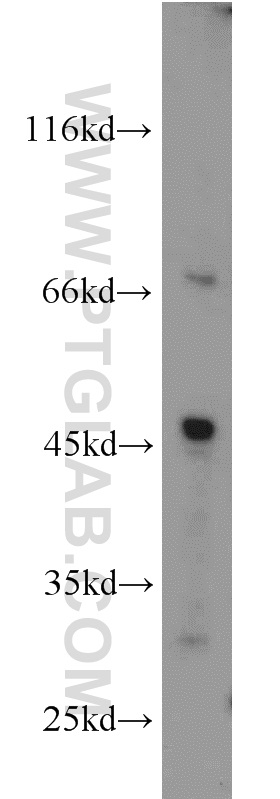 WB analysis of L02 using 13150-1-AP