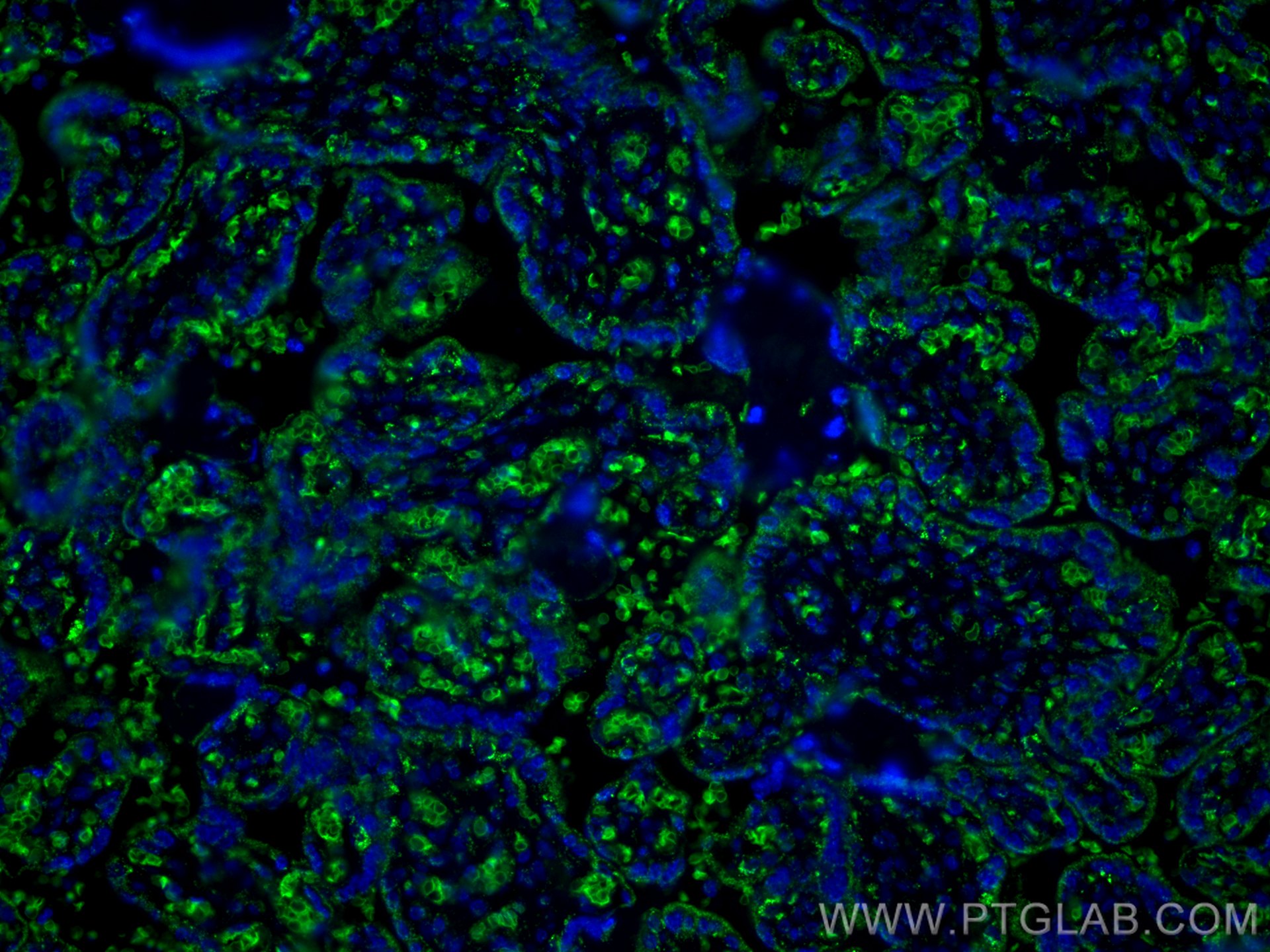 IF Staining of human placenta using 18147-1-AP