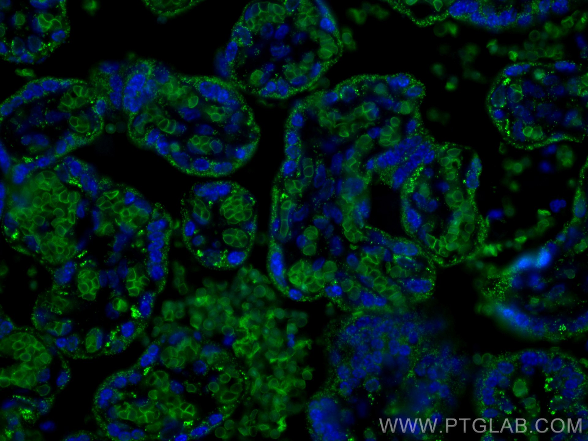 IF Staining of human placenta using 18147-1-AP