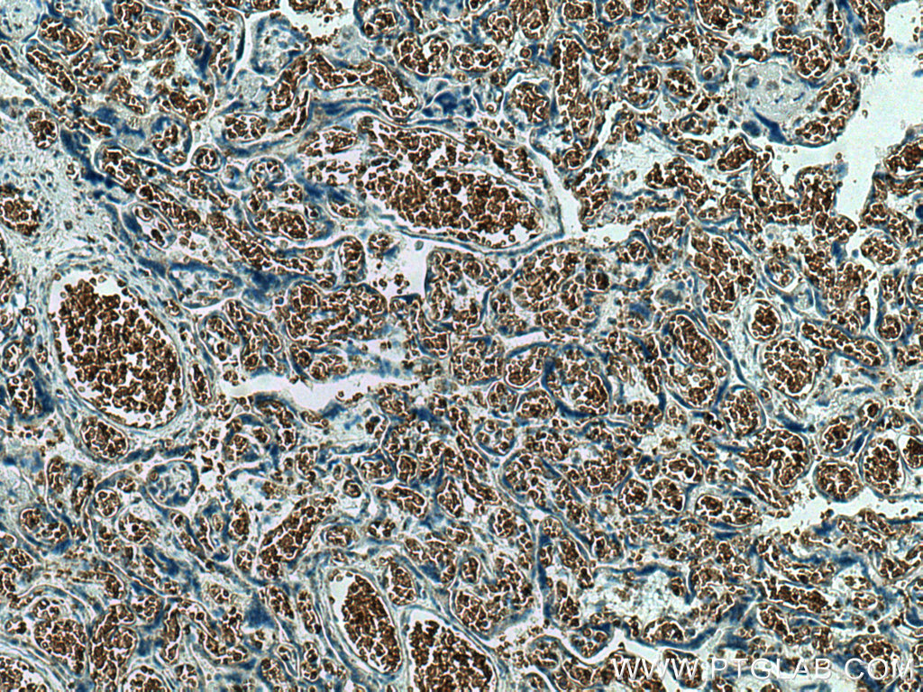 IHC staining of human placenta using 18147-1-AP