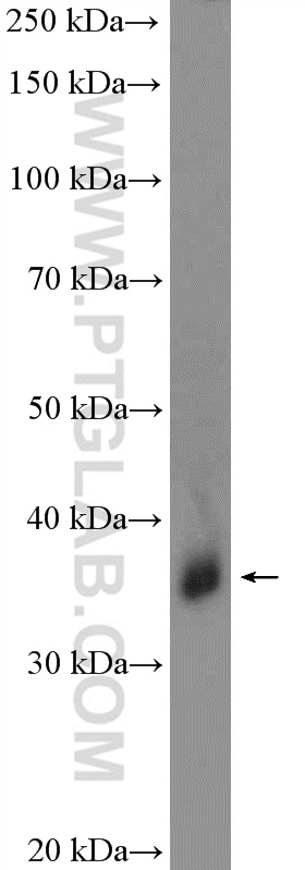 WB analysis of human blood using 18147-1-AP