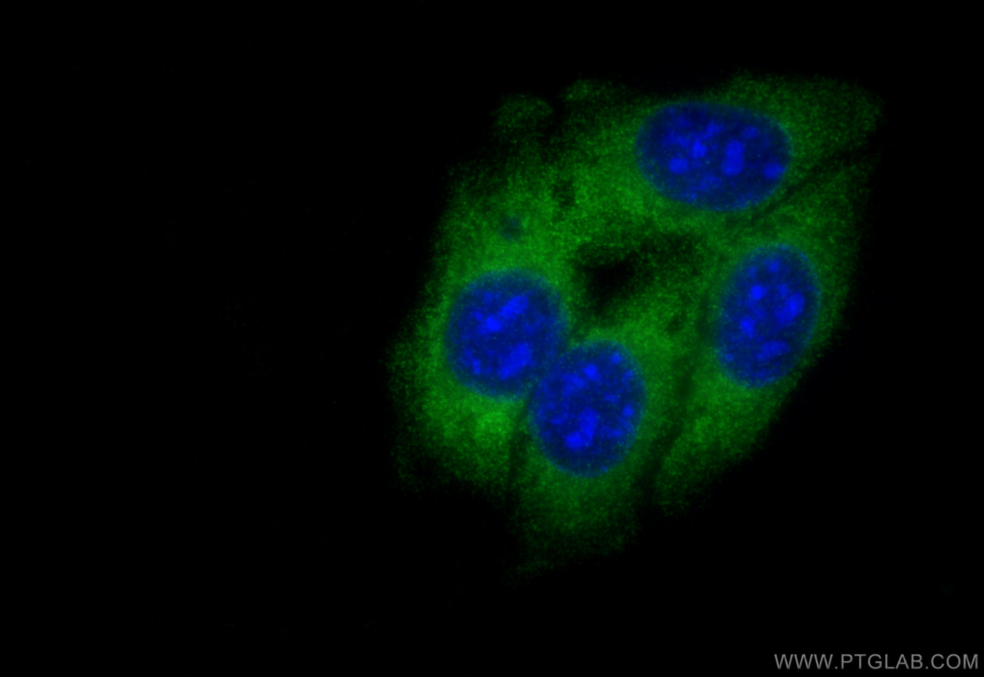 IF Staining of HepG2 using 10566-1-AP