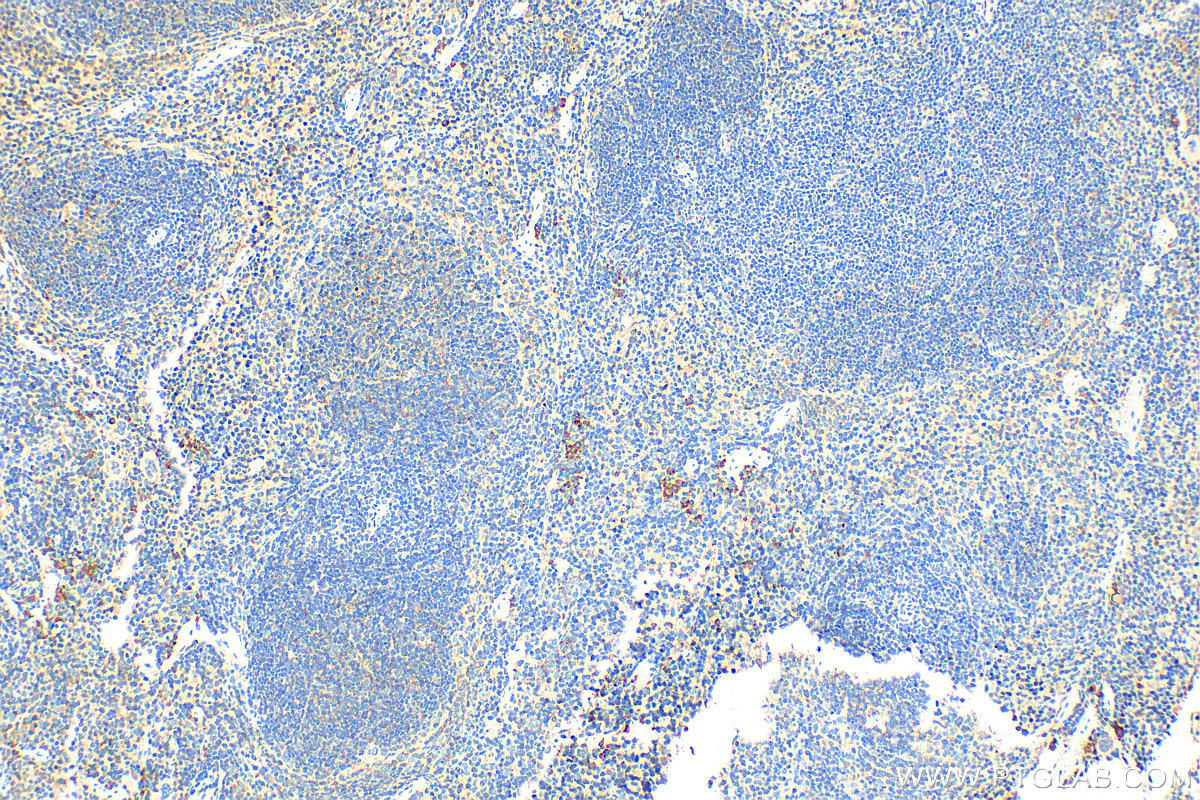 IHC staining of mouse spleen using 13588-1-AP