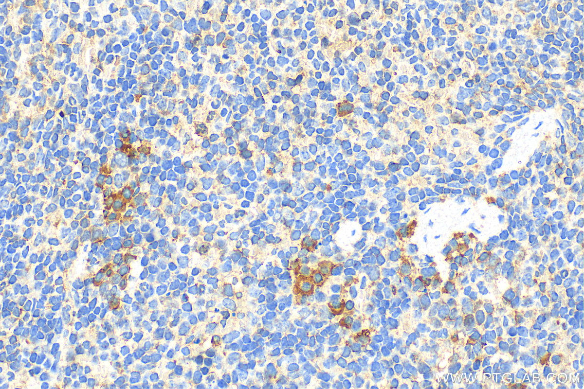 IHC staining of mouse spleen using 13588-1-AP