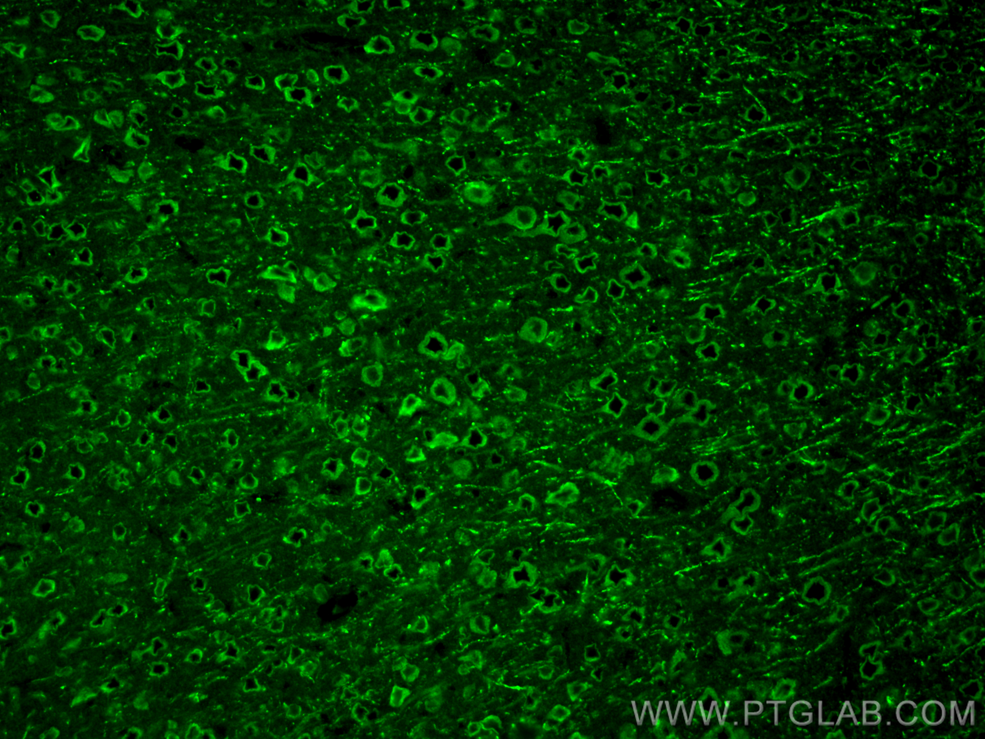 IF Staining of mouse brain using 11991-1-AP