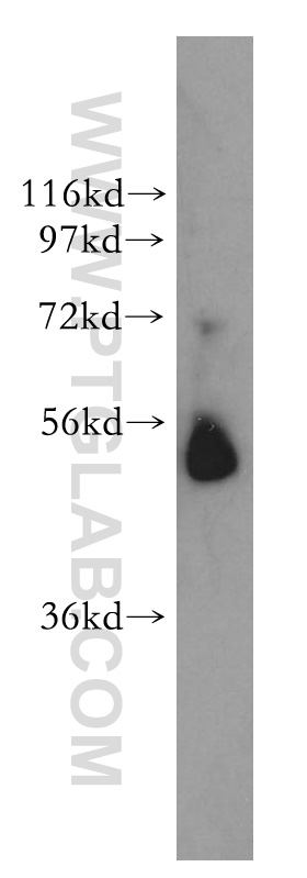 WB analysis of A375 using 51049-2-AP