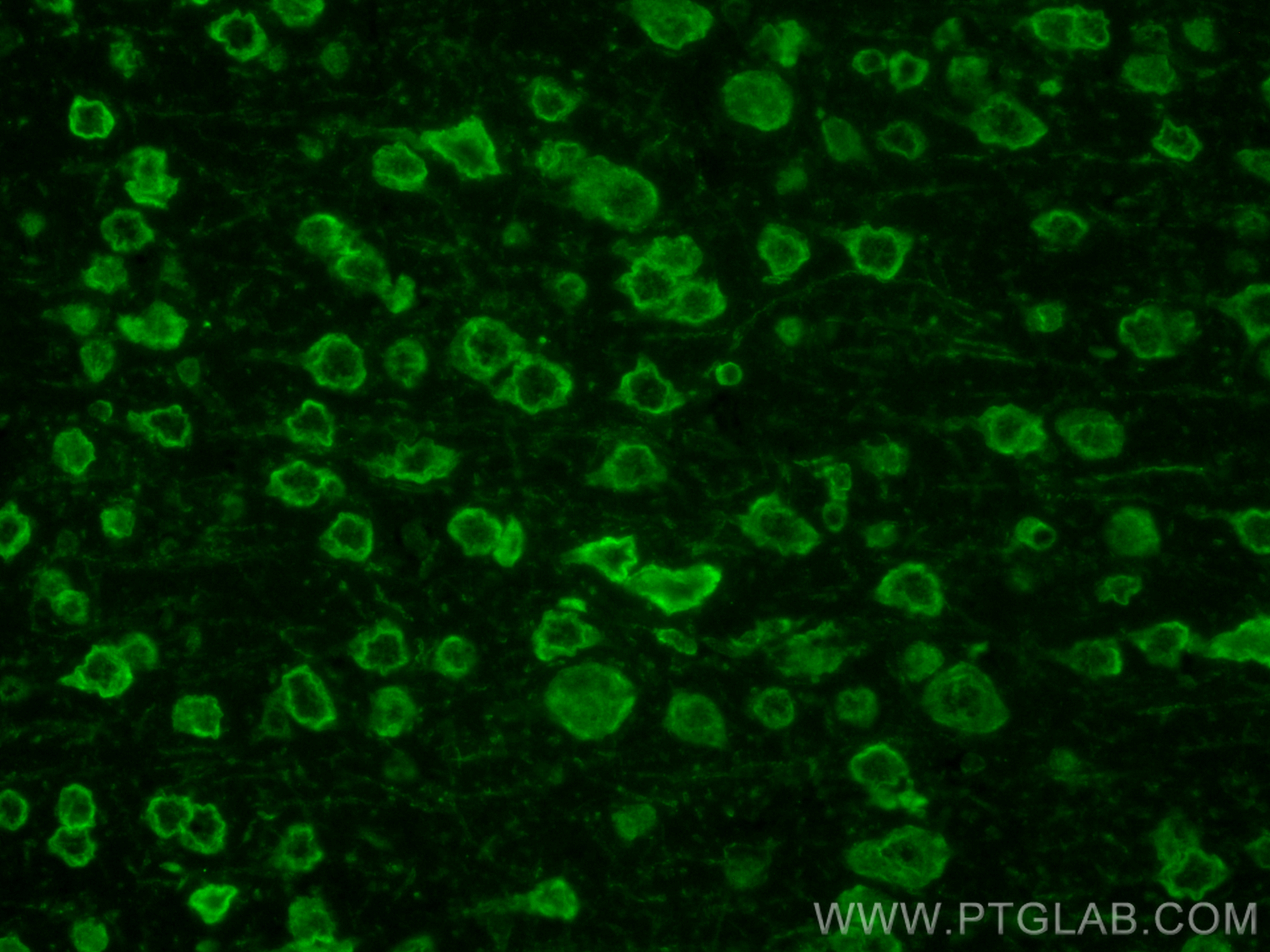 IF Staining of mouse brain using CL488-11991