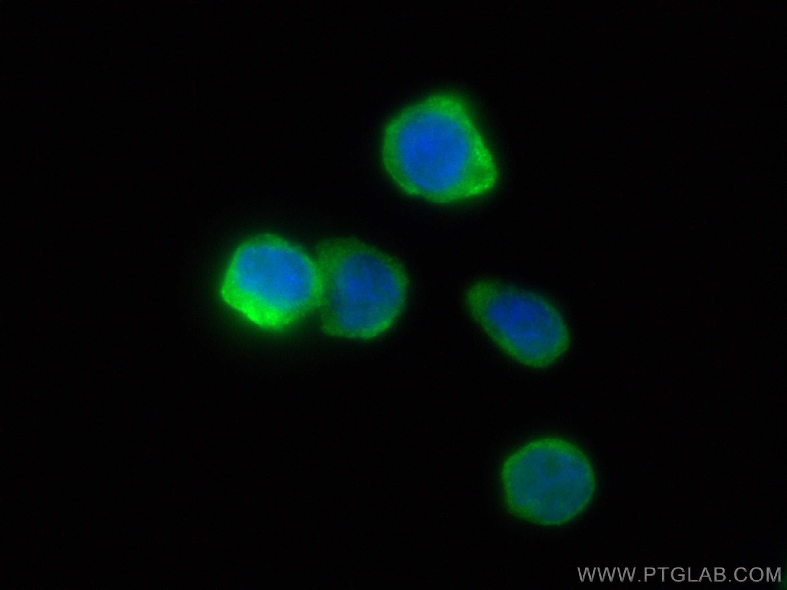 IF Staining of THP-1 using 25225-1-AP