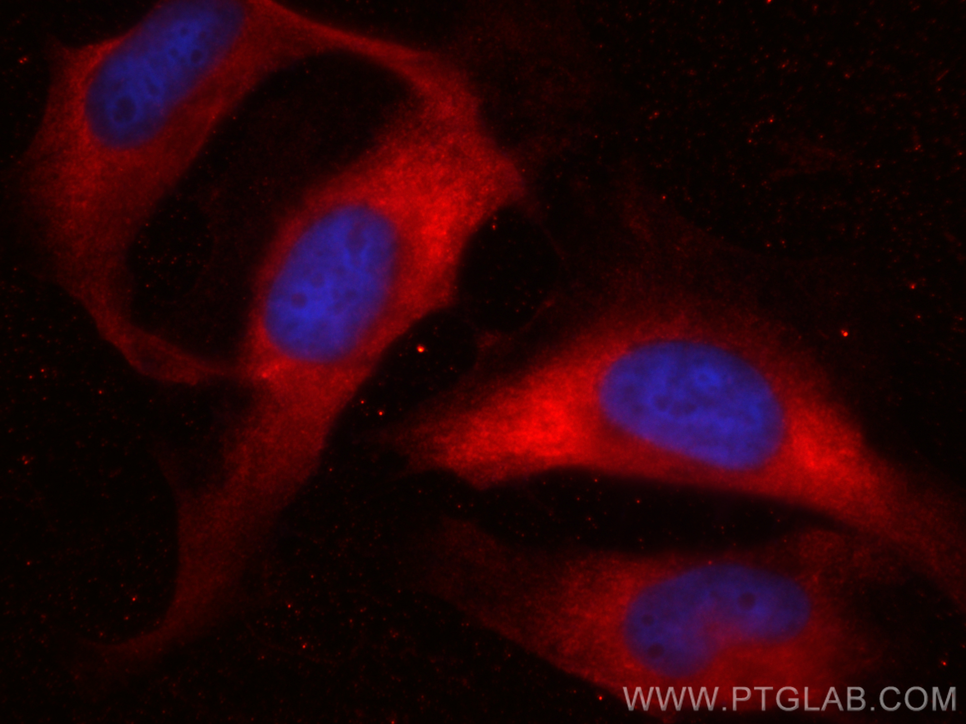 IF Staining of HeLa using CL594-60207