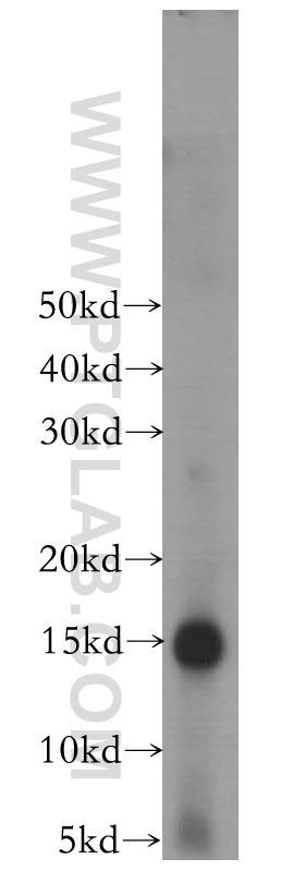 WB analysis of mouse skin using 16730-1-AP