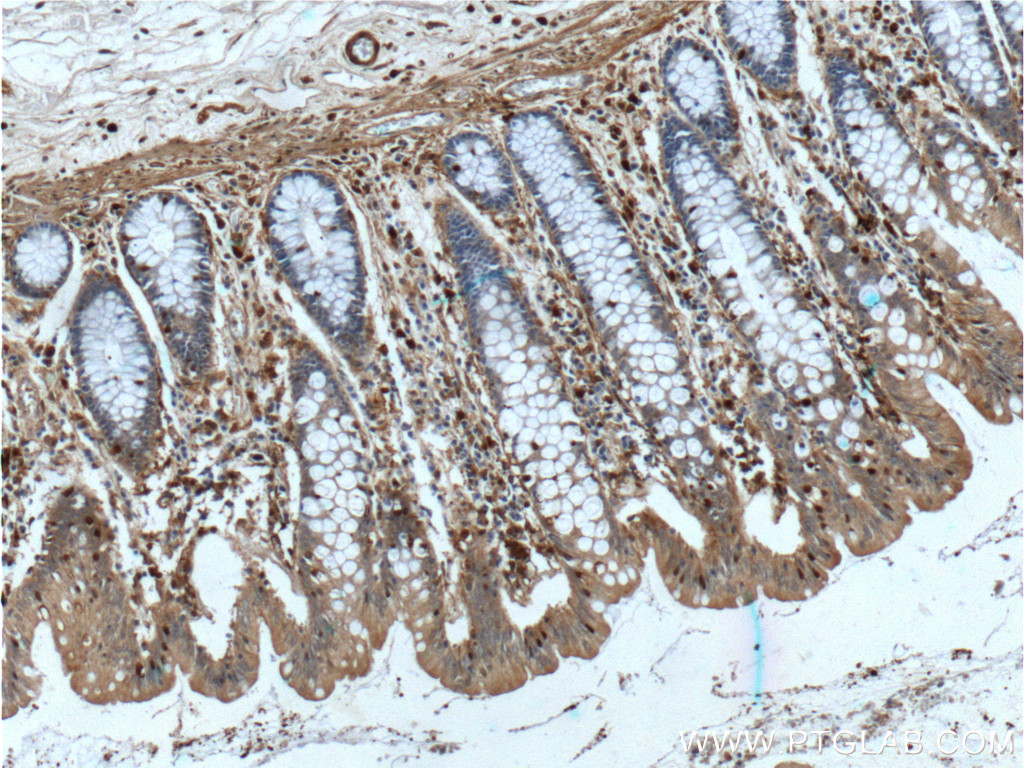 IHC staining of human colon using 66280-1-Ig