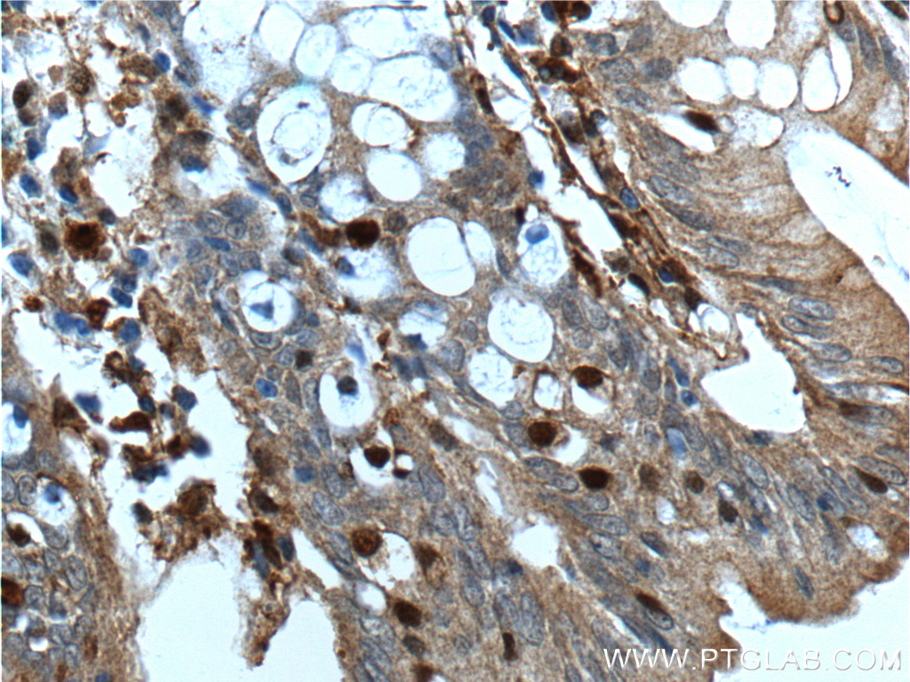 IHC staining of human colon using 66280-1-Ig (same clone as 66280-1-PBS)