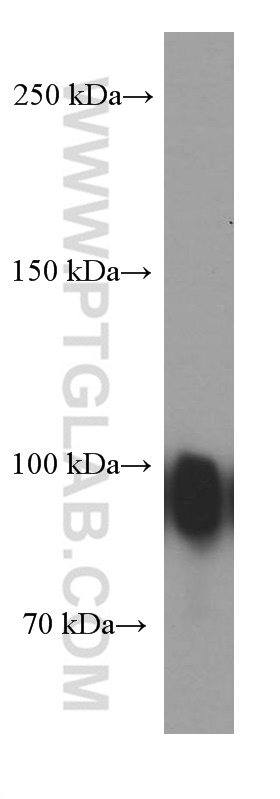 WB analysis of human plasma using 66280-1-Ig