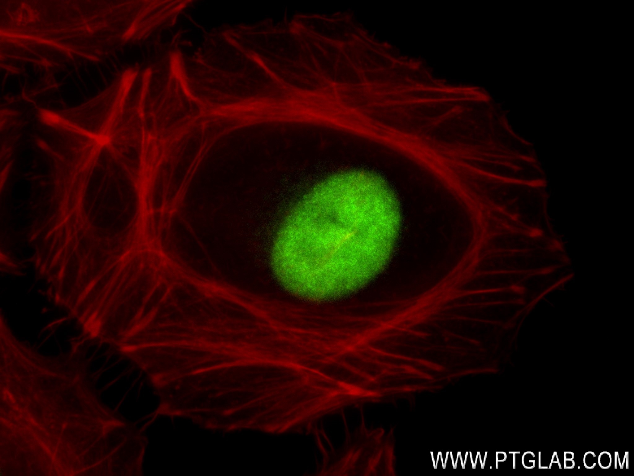 IF Staining of HeLa using 84199-2-RR