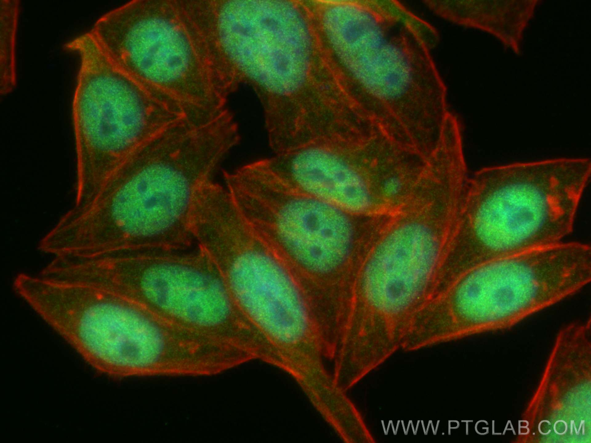 IF Staining of HepG2 using 82619-4-RR