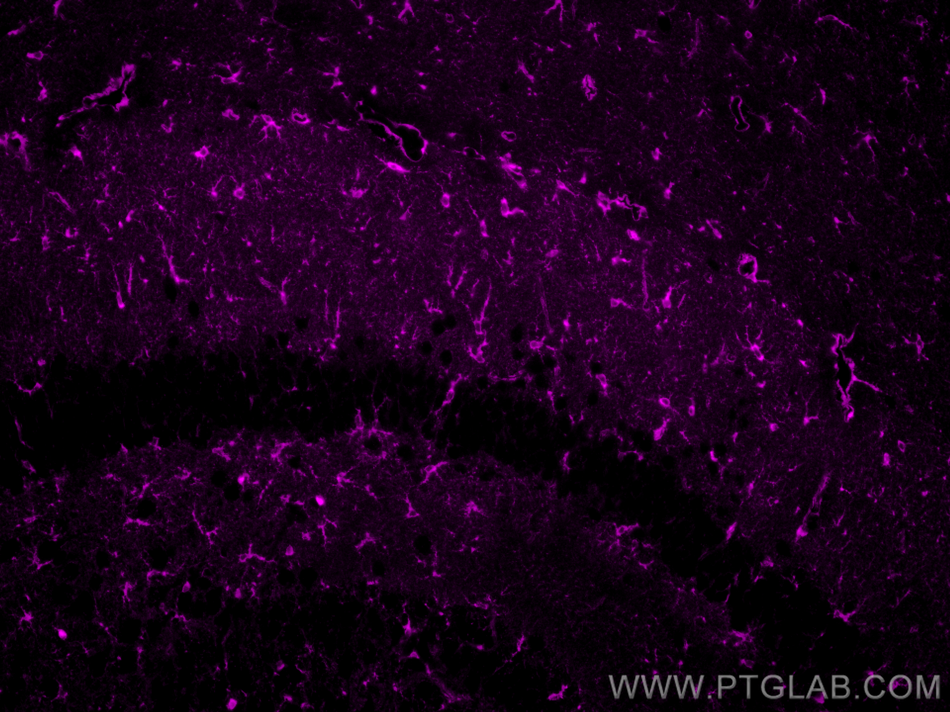 IF Staining of mouse brain using CL647-66323-2