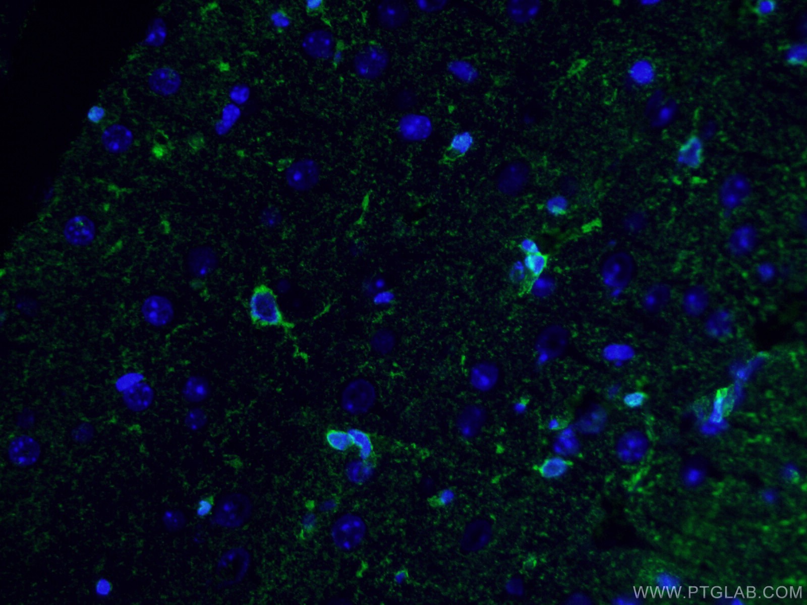 Glutamine Synthetase