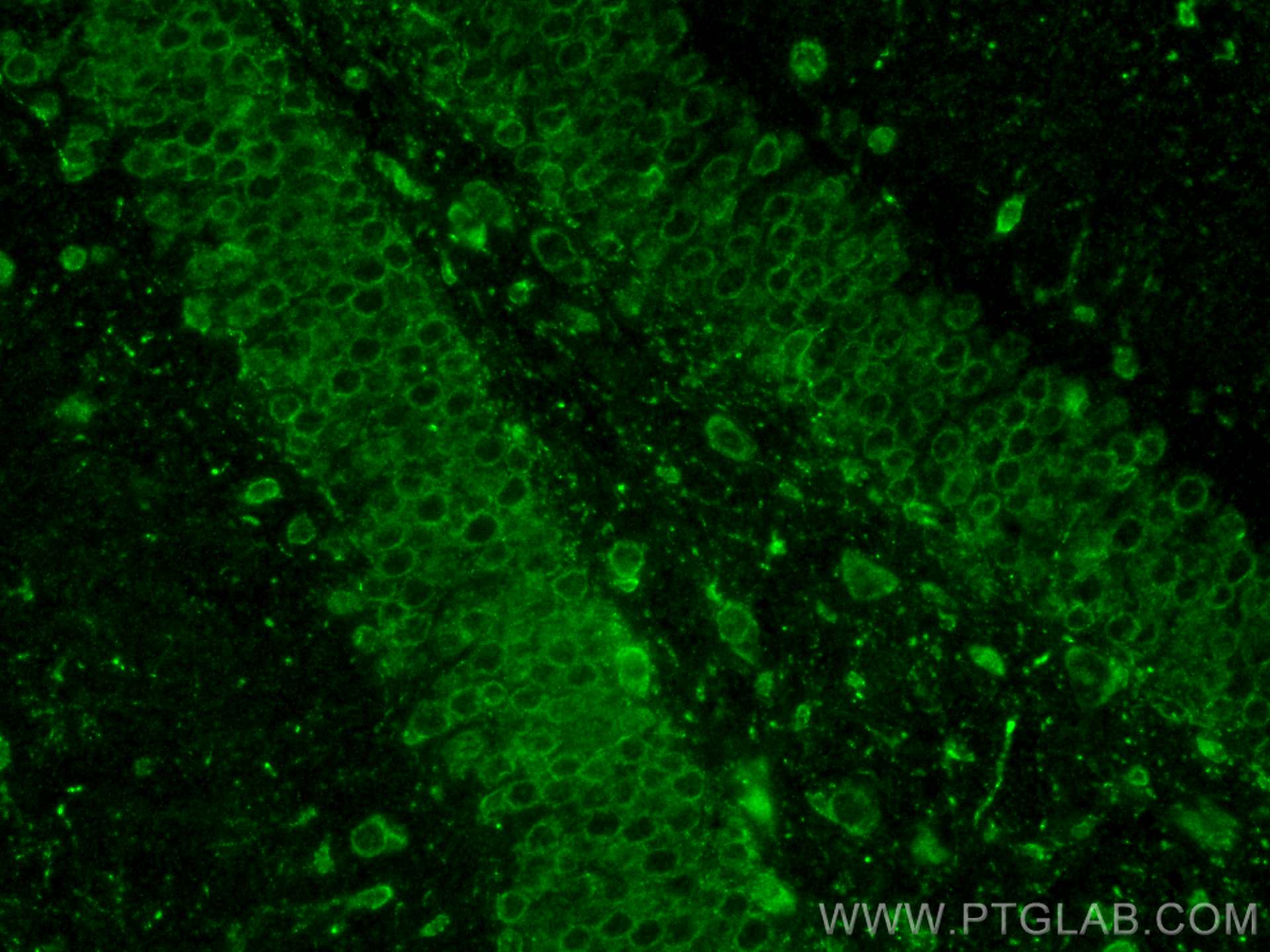 IF Staining of mouse brain using 25948-1-AP