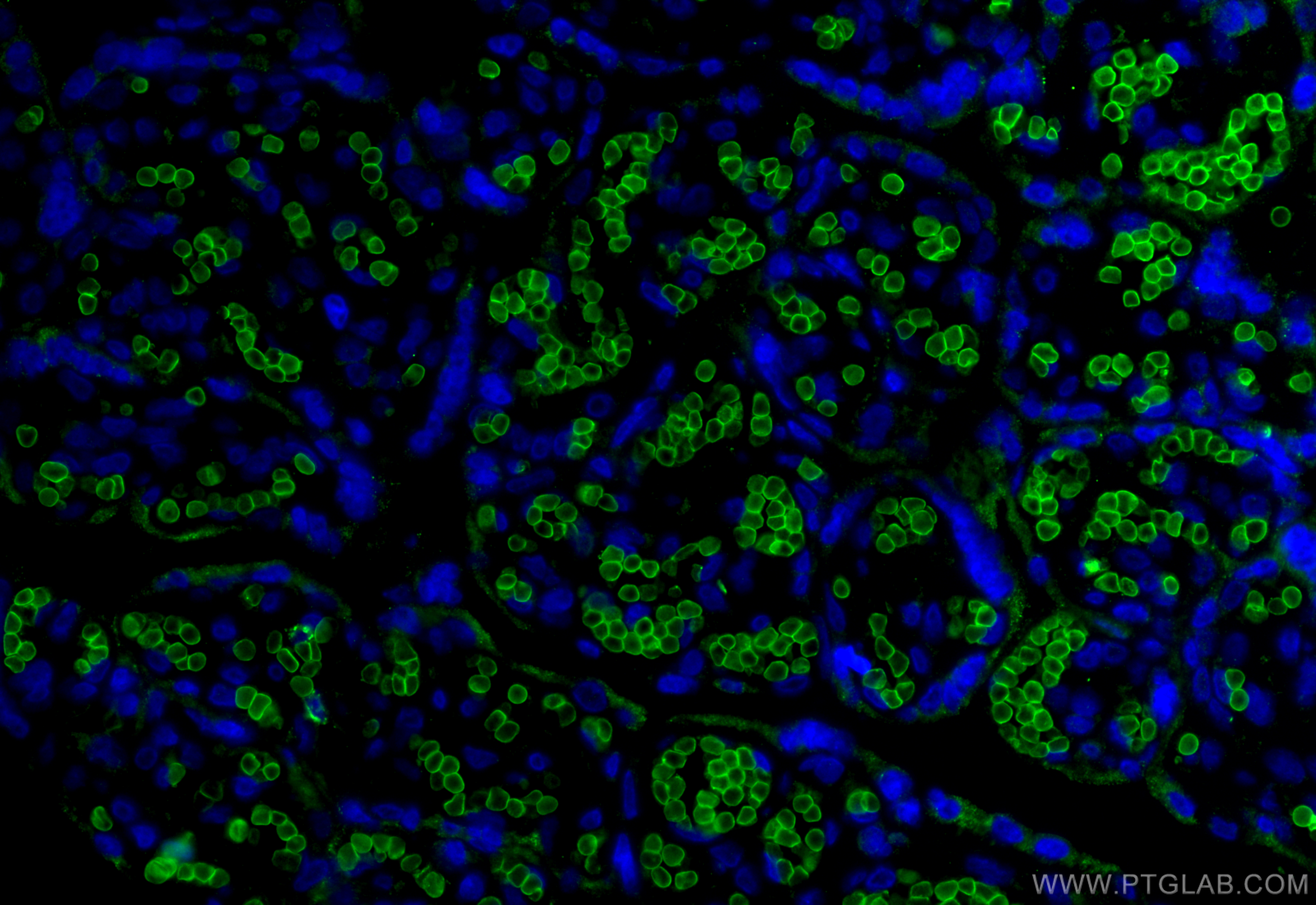 IF Staining of human placenta using 66778-1-Ig (same clone as 66778-1-PBS)