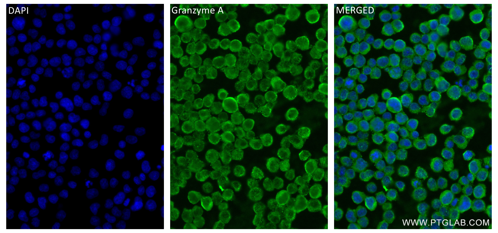 Granzyme A