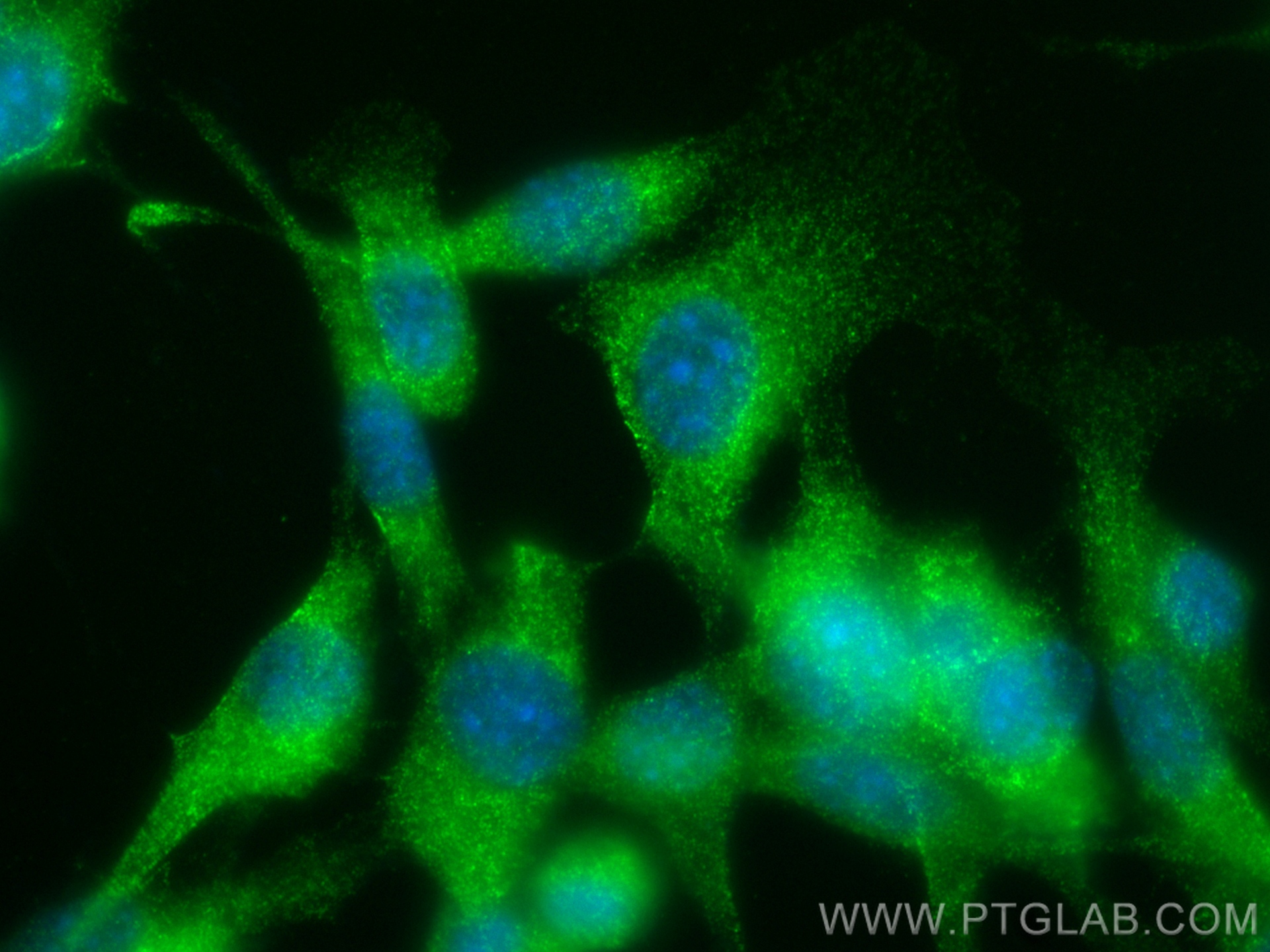 IF Staining of NIH/3T3 using 83562-3-RR (same clone as 83562-3-PBS)