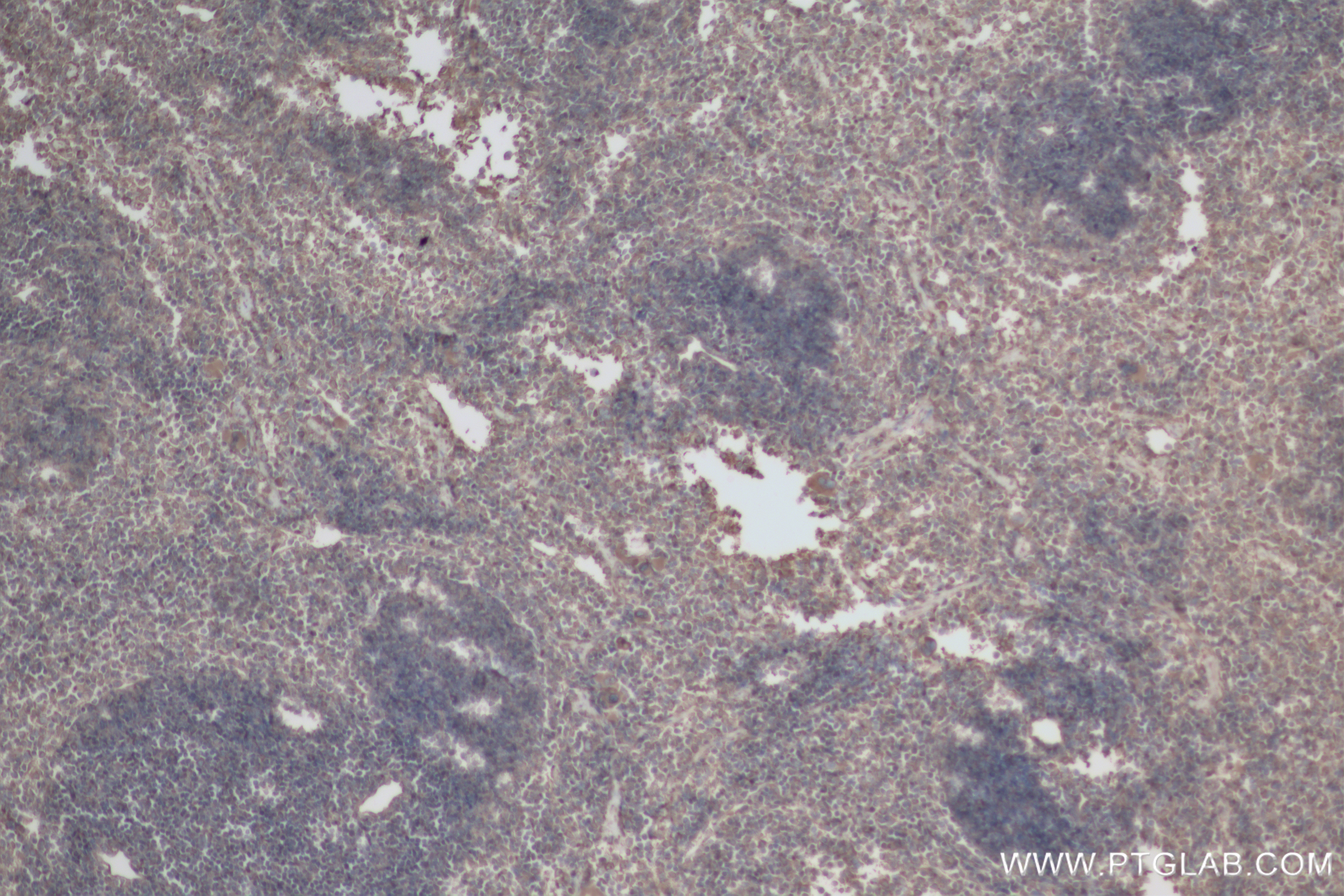 IHC staining of mouse spleen using 83562-3-RR (same clone as 83562-3-PBS)